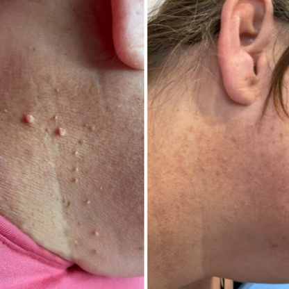 ALCURA™ Komplett Set Bundle