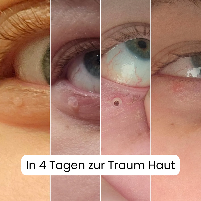 ALCURA™ Komplett Set Bundle